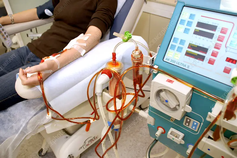 dialysis machine
